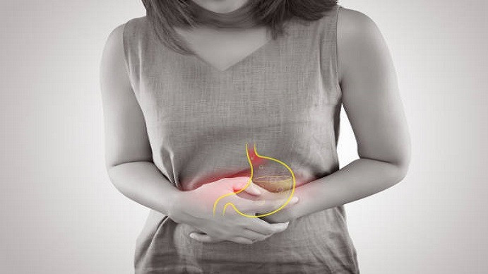 GERD Sering Kambuh? Ini Daftar Makanan yang Perlu Dihindari Menurut dr Zaidul Akbar
            - galeri foto