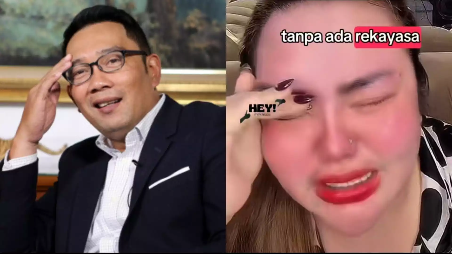 Apes! Hasil Tes DNA Negatif bersama Ridwan Kamil, Lisa Mariana Dihadapi Gugatan Sebanyak Rp 105 Miliar