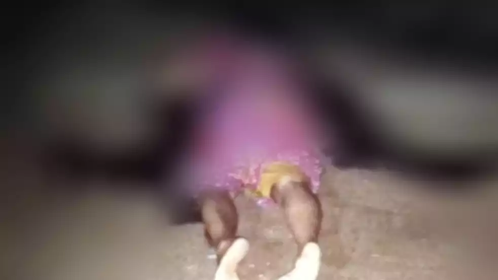 Seorang Pria Serang 1 Keluarga di Pacitan  1Tewas dan Empat Lainnya Luka-Luka