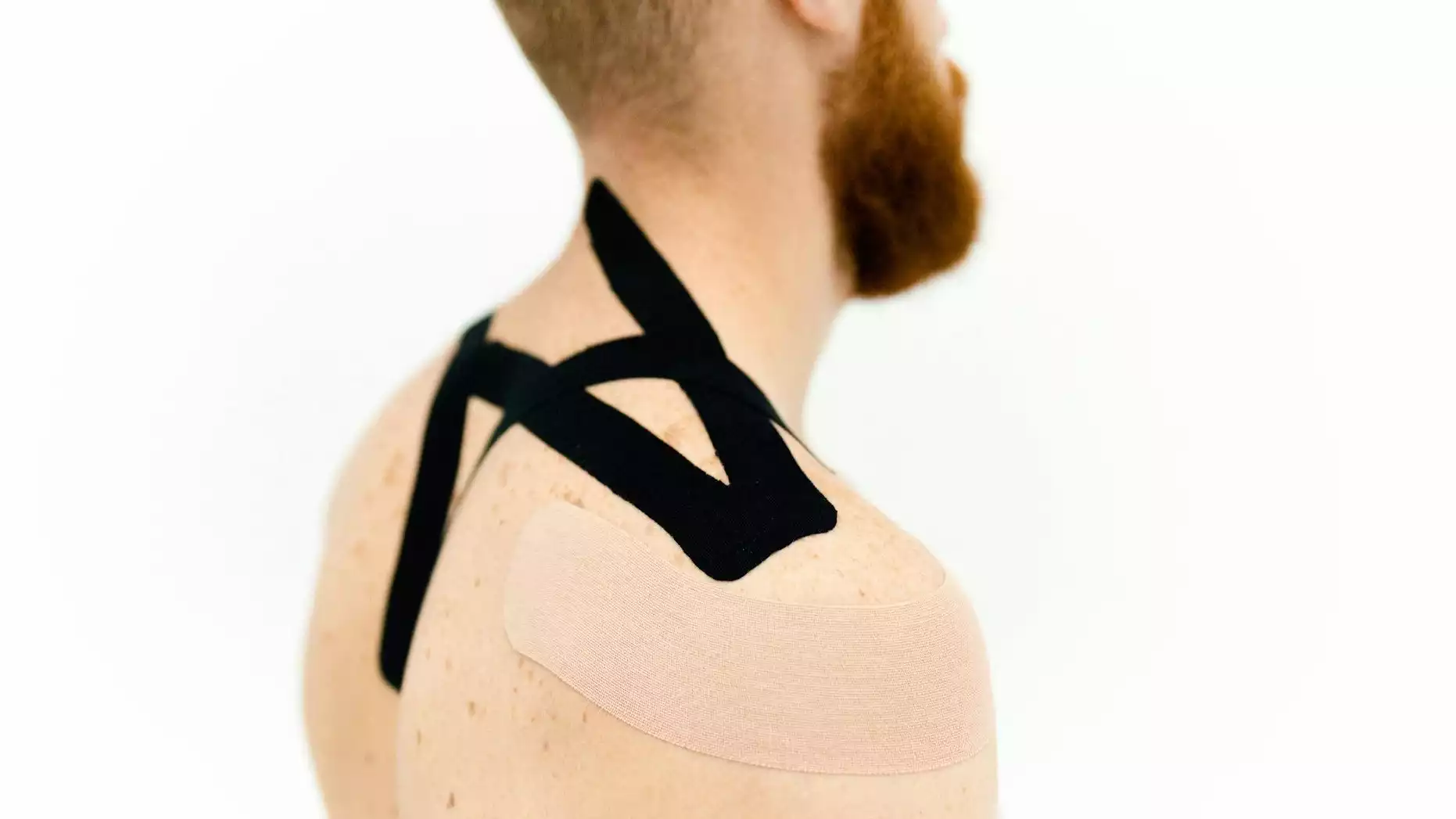 Ilustrasi cedera bahu