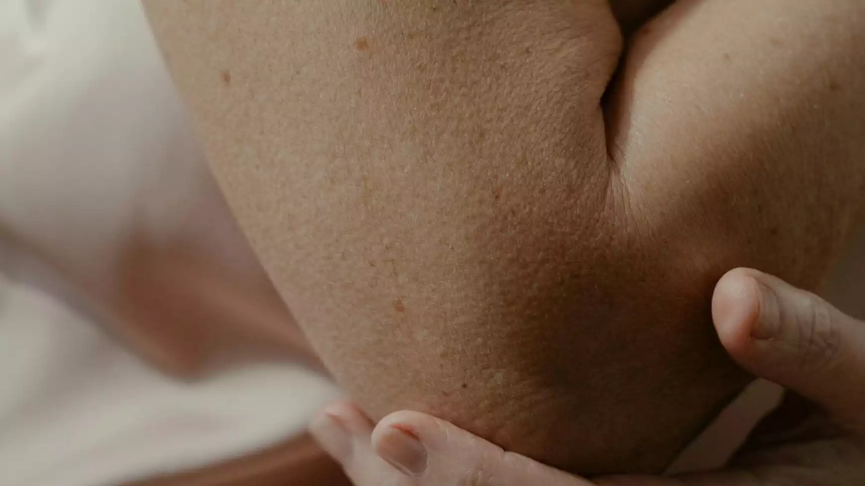 Ilustrasi cedera elbow