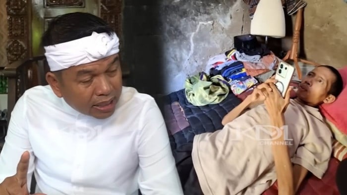 Gubernur Jawa Barat, Dedi Mulyadi (KDM) menyikapi kondisi pilu Suryana, warga Tasikmalaya akibat menderita penyakit diabetes akut