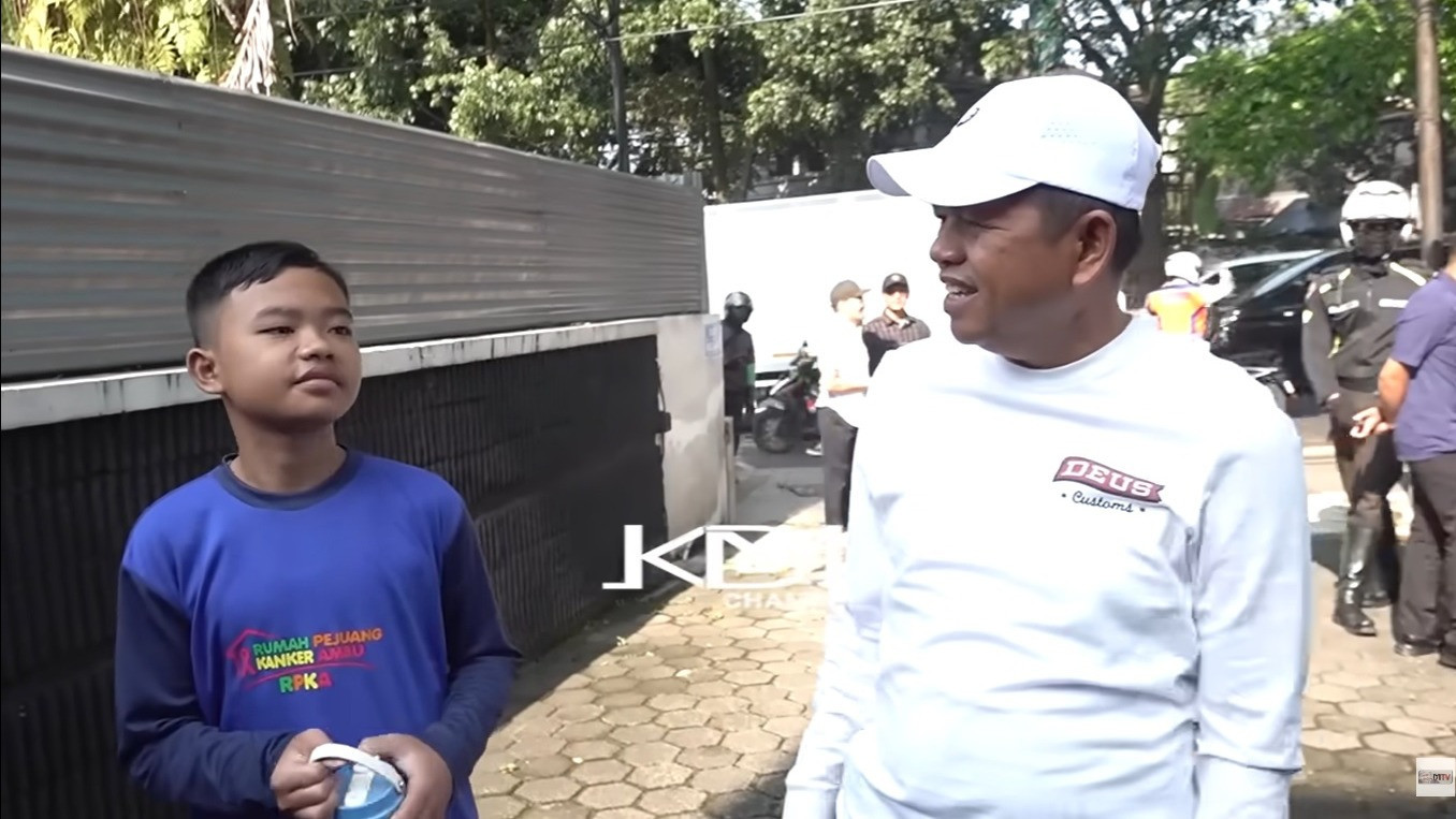 Dedi Mulyadi dan bocah SD penderita kanker stadium 4