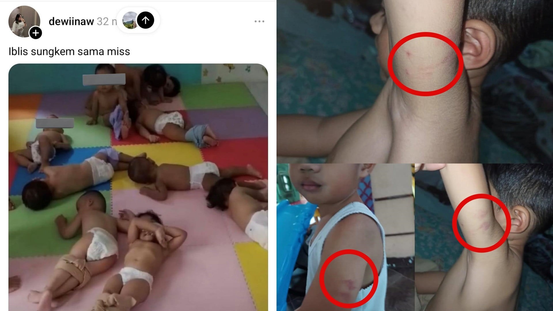 Penganiayaan massal di daycare Little Aresha Yogyakarta