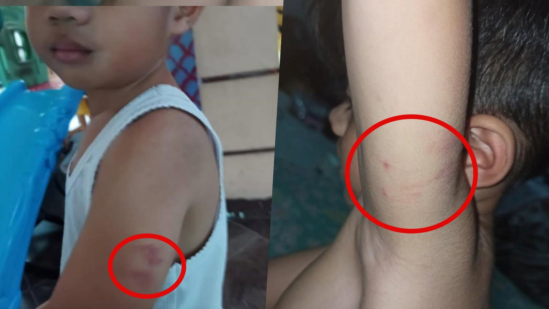 Penganiayaan anak secara massal di daycare Little Aresha Yogyakarta