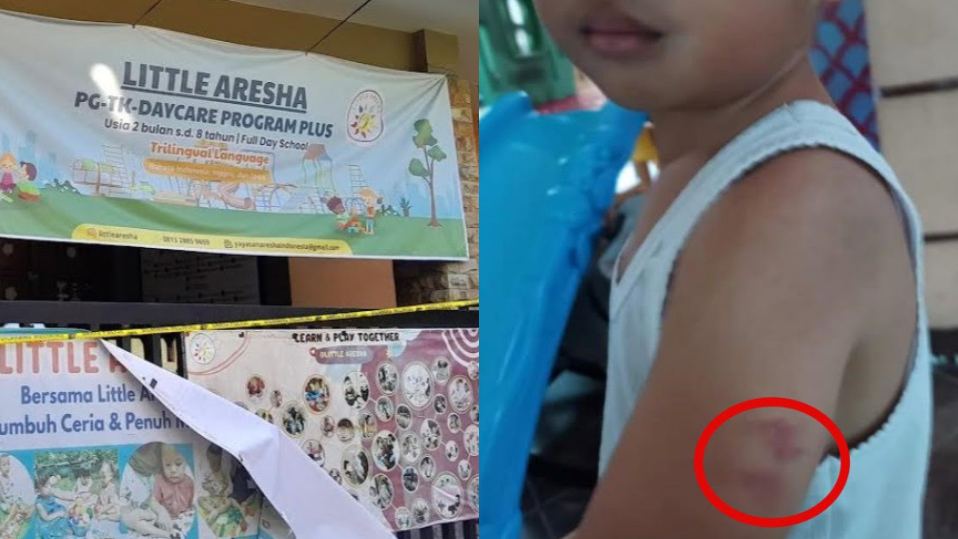 Heboh Dugaan Kekerasan Fisik pada Anak, Kepala Yayasan hingga 11 Pengasuh di Little Aresha Yogyakarta Ditetapkan Tersangka