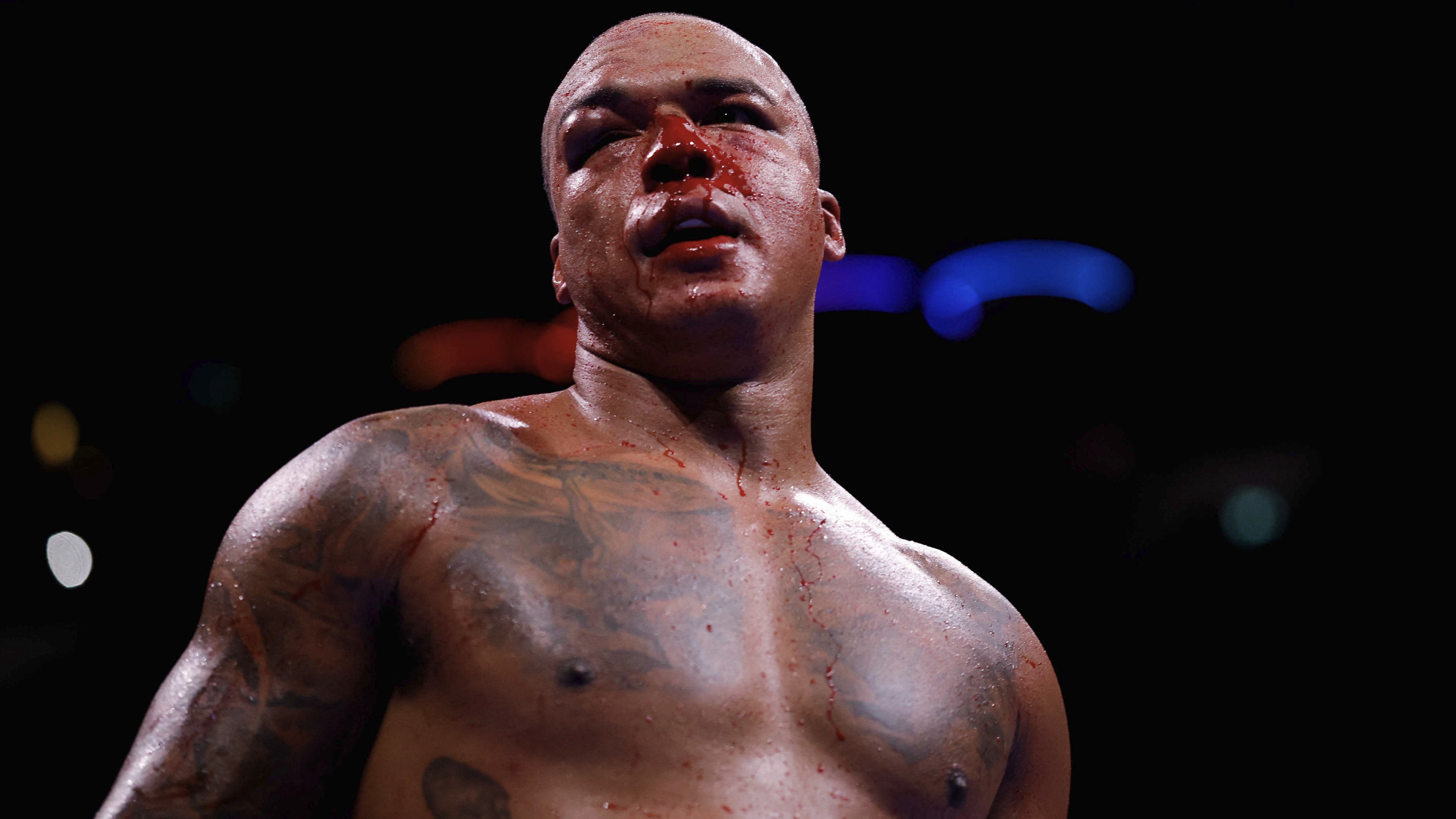 Fabio Wardley terluka usai dihantam Daniel Dubois