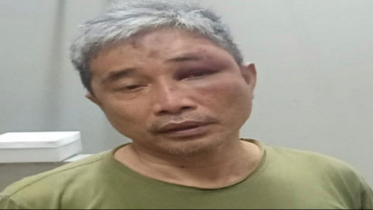 Ini Lho! Penampakan M Kece Sesaat Setelah Dihajar Irjen Pol Napoleon di Rutan