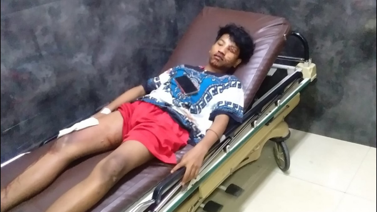 Kecelakaan Maut di Tol Cipali, Seluruh Korban Ber-KTP Jakarta
            - galeri foto