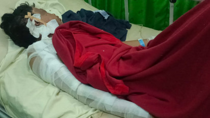 Daar, Seorang Remaja di Kalapanunggal Sukabumi Tersambar Petir