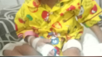 Miris, Balita 2,5 Tahun di Kota Batu Disiksa Calon Ayah Sambung