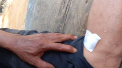 Buaya Gigit Ketua DPRD Bangka