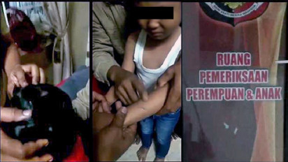 Bocah 7 Tahun Diduga Menjadi Korban Penganiayaan Calon Ibu Tiri