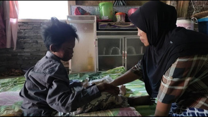 Tangan dan Kaki Melepuh, Bocah Asal Pandegelang Butuh Bantuan untuk Berobat