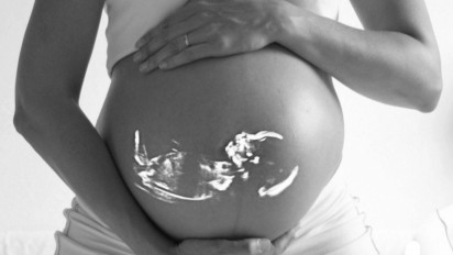 Waspada!!! Ini Faktor Risiko Sebabkan Kelahiran Bayi Prematur