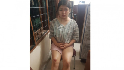 Kaki dan Tangan Diikat serta Mulut Disumpal, Wanita Cantik Nekat Lompat dari Mobil yang Dipesan via Aplikasi Online