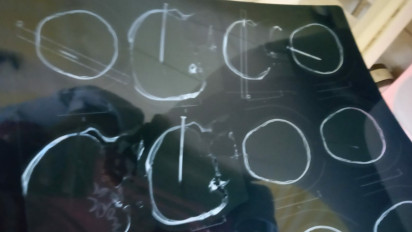 Cerai Dengan Istrinya, Seorang Pria di Gunungkidul Memaku Dahinya Sendiri