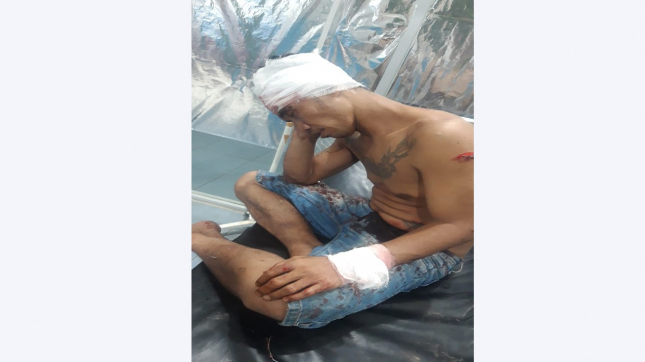 Dibacok OTK, Dua Warga Deli Serdang Terkapar Bersimbah Darah
            - galeri foto