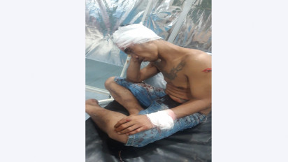 Dibacok OTK, Dua Warga Deli Serdang Terkapar Bersimbah Darah