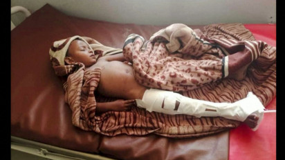 Serangan Udara Terjadi di Wilayah Tigray Ethiopia Menewaskan 56 Orang