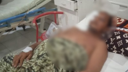 Seorang Warga Aceh Dilaporkan Diinjak Gajah, BKSDA Aceh Minta Warga Tidak Main Hakim Sendiri