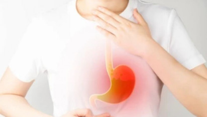 GERD Tak Mengancam Jiwa Tapi Berbahaya Jika Tak Diobati