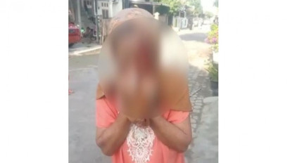 Tak Tahan Disiksa Anak Kandung Pecandu Sabu, Nenek 64 Tahun Ini Melapor ke Polisi