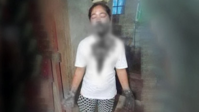 Cemburu Buta, IRT di Bangka Selatan Bersimbah Darah Dibacok Mantan Suami