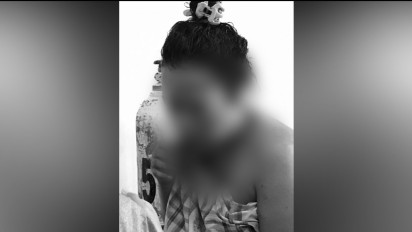 Sadis, Seorang Suami di Konawe Utara Tega Sayat Wajah Istri Sendiri