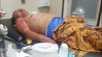 Tengah Makan di Rumahnya Seorang Pria Tersambar Petir