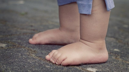 Waspadai Stunting, Jika Berat Badan Anak Dibawah Dua Tahun Kurang Memadai