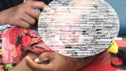 Korban Gigitan Anjing Gila di Sumbawa Barat Capai 43 Orang, Pemda Tetapkan KLB Rabies