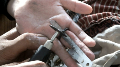 Panik, Jari Bocah 7 Tahun di Banyumas Terjebak di Slot Teralis Jendela