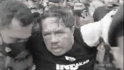 Kapolda Metro Jaya: Ade Armando Alami Luka Parah di Kepala