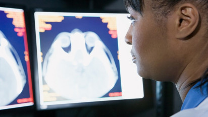 Sering Mendadak Bingung? Mungkin Kamu Kena Brain Fog