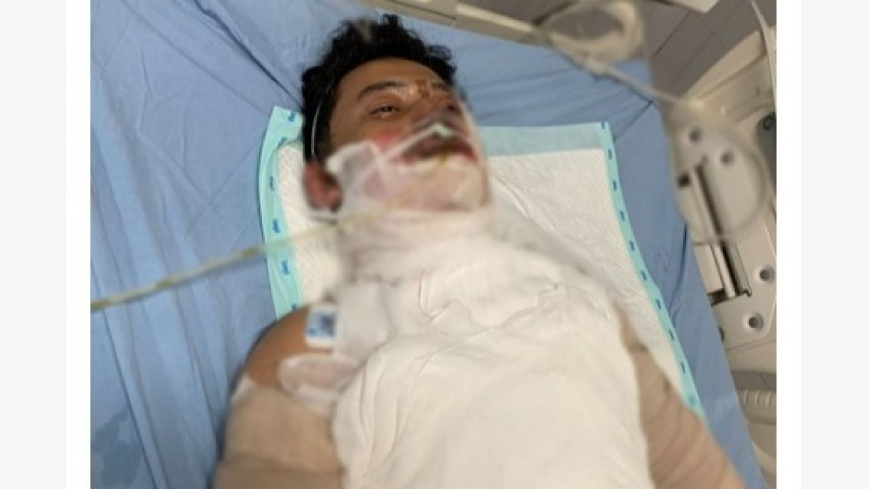 Mahasiswa UTY Dibakar Teman, Alami 80 Persen Luka Bakar
            - galeri foto