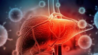 Hepatitis Akut Berjumlah 170 Kasus di Sejumlah Negara