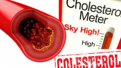 Cara Mudah Cek Kolesterol Tanpa Alat Tes, Lakukan di Rumah Saja, Tak Perlu ke Dokter