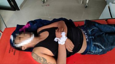 Melawan Saat Ditangkap, Pelaku Begal Tewas Ditembak