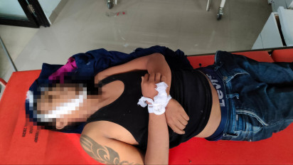 Melawan Saat Ditangkap, Pelaku Begal Tewas Ditembak