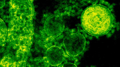 Covid-19 Belum Selesai, Kini Ditemukan Virus Hendra (HeV). Awalnya Ditularkan Dari Kelelawar!