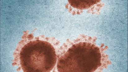 Duh! Muncul Varian Baru Virus Hendra yang Berbahaya. Penebangan Hutan Jadi Penyebabnya?