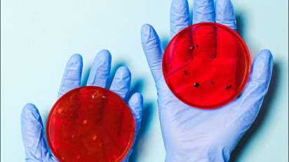 Varian Baru Virus Hendra Ditemukan, Jangan Takut! Ikuti Cara Pencegahannya