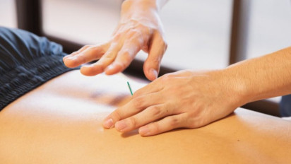 Migrain Minggat dengan Rutin Akupuntur