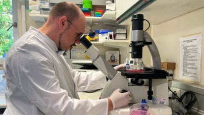 WHO Desak Negara-Negara Segera Bendung Penyebaran Cacar Monyet