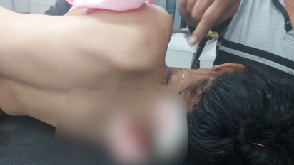 Emosi Ditagih Uang Sewa Kamar, Ucok Tusuk Teman Kencannya Hingga Tewas