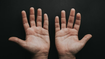 Hati-Hati! Munculnya Hal Ini di Tangan Bisa Jadi Pertanda Kolesterol Tinggi