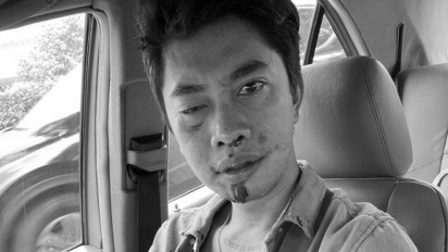 Ini Kondisi Justin Frederick, Korban Pemukulan Pengemudi Mobil Pelat RFH di Tol