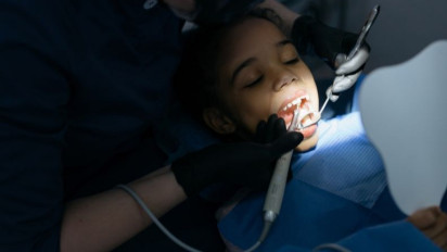 Pakai Gigi Palsu, Jangan Lupa Merawatnya Demi Jaga Kesehatan