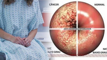 Berbahaya Nih, Kanker Serviks Stadium Awal Tak Ada Gejalanya Sama Sekali, Wanita Harus Baca Ini